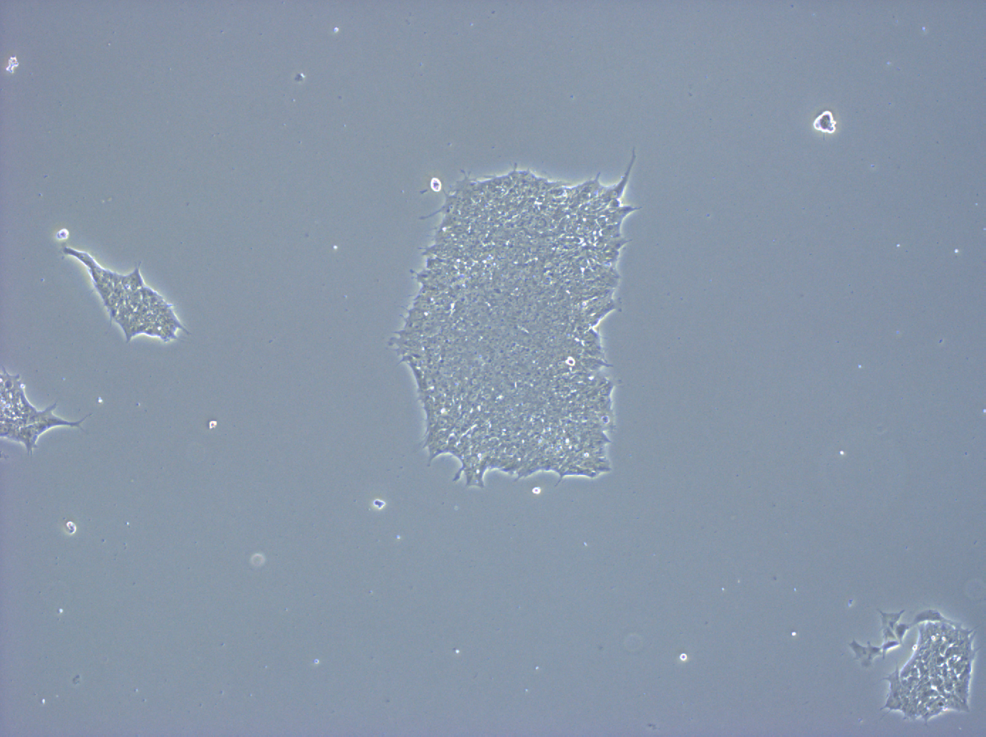 Stem cell model