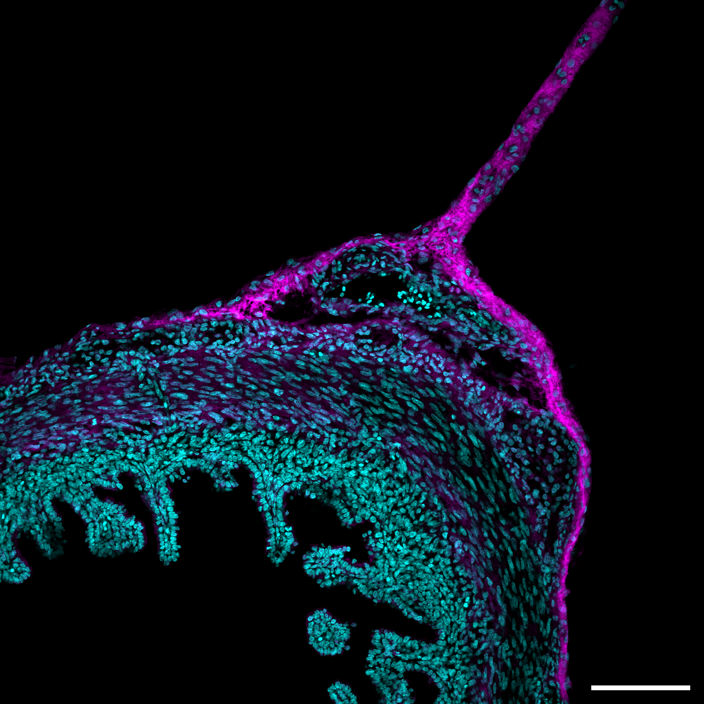 Gut Section