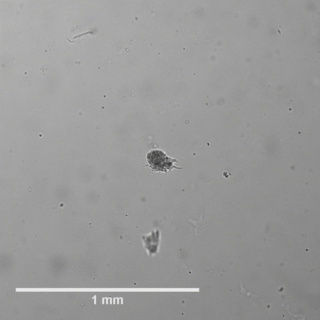 Human Intestinal Organoid