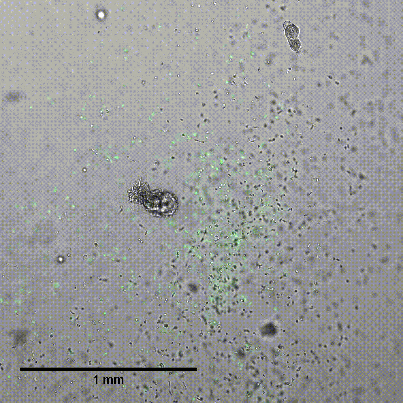 Human Intestinal Organoid with an ENS