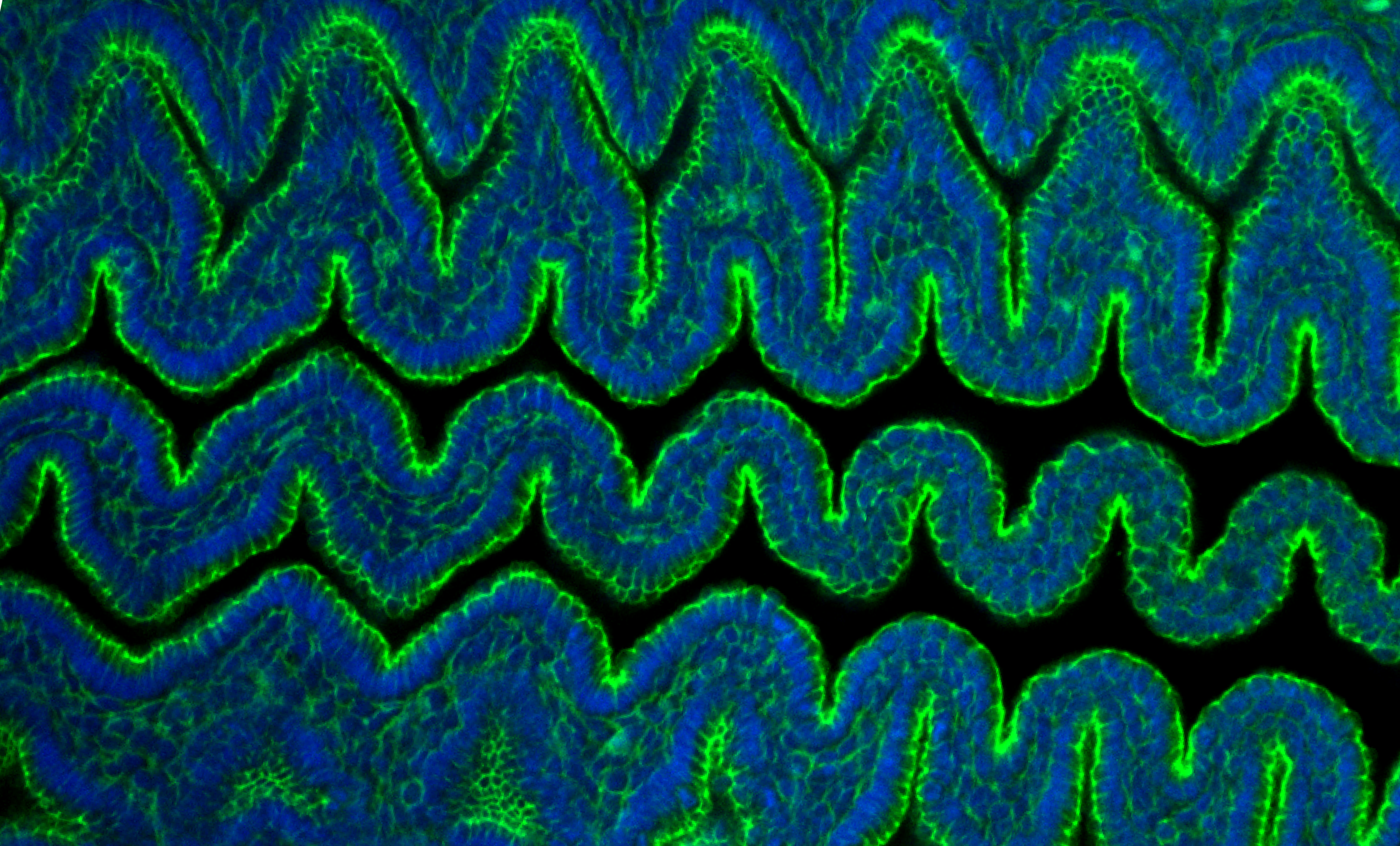 gut looping